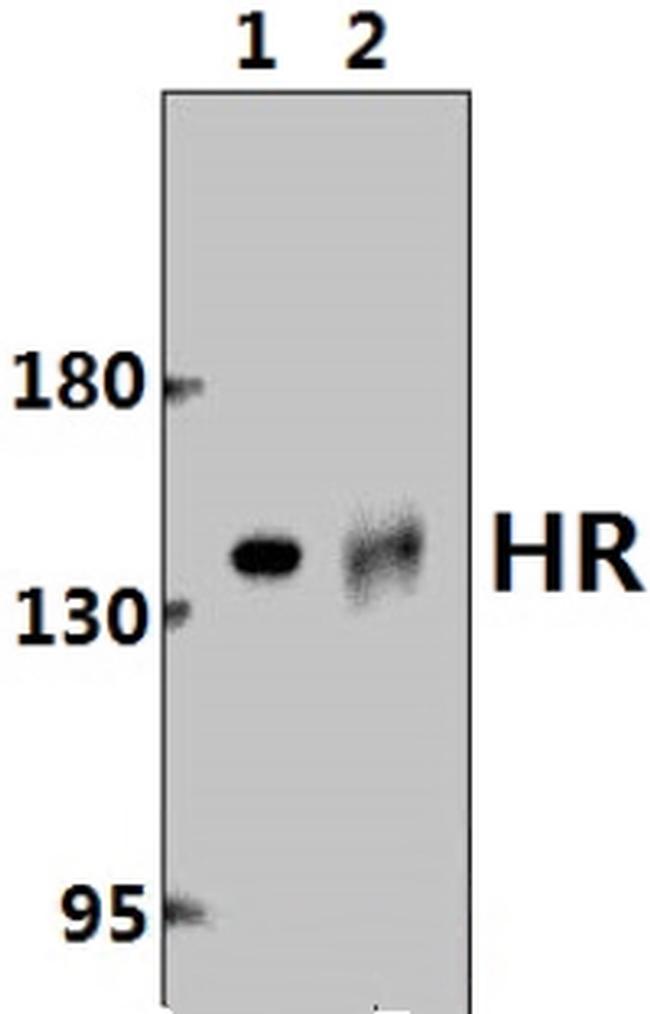 Hairless Antibody in Western Blot (WB)