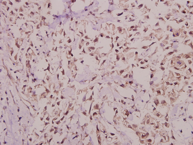 Hairless Antibody in Immunohistochemistry (Paraffin) (IHC (P))