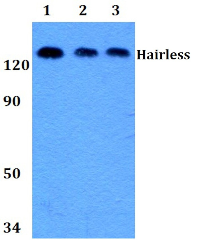 Hairless Antibody in Western Blot (WB)