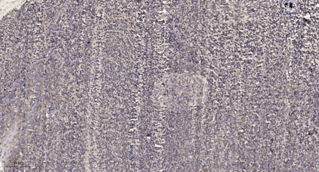 Phospho-Progesterone Receptor (Ser294) Antibody in Immunohistochemistry (Paraffin) (IHC (P))