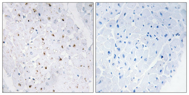 Phospho-Blooms Syndrome (Thr99) Antibody in Immunohistochemistry (Paraffin) (IHC (P))