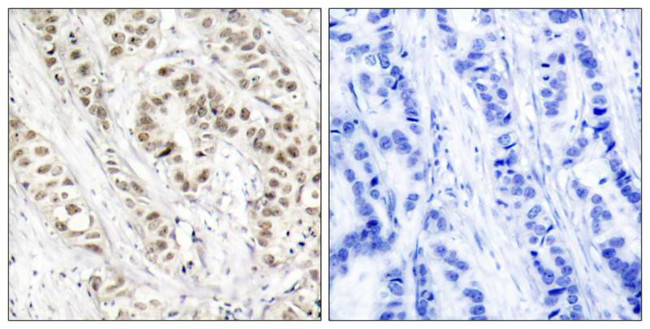 Phospho-BRCA1 (Ser1524) Antibody in Immunohistochemistry (Paraffin) (IHC (P))