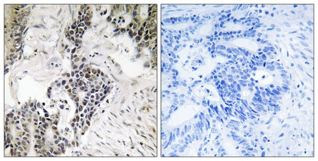 Phospho-Cdc25C (Ser198) Antibody in Immunohistochemistry (Paraffin) (IHC (P))