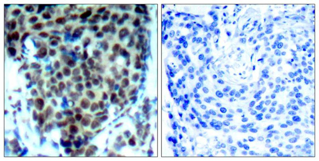 Phospho-p38 MAPK (Thr180) Antibody in Immunohistochemistry (Paraffin) (IHC (P))