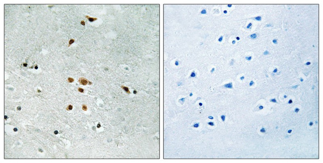 Phospho-FER (Tyr402) Antibody in Immunohistochemistry (Paraffin) (IHC (P))