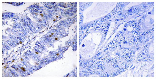 Phospho-NR4A1 (Ser351) Antibody in Immunohistochemistry (Paraffin) (IHC (P))