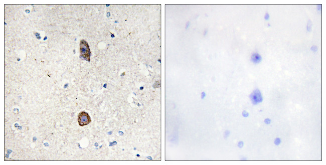 Phospho-IGFBP3 (Ser183) Antibody in Immunohistochemistry (Paraffin) (IHC (P))