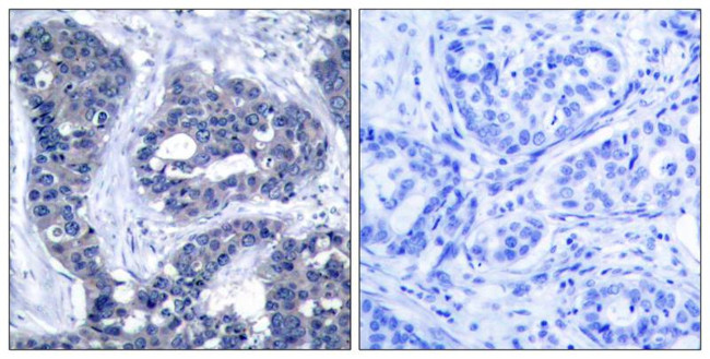 Phospho-IRS1 (Ser639) Antibody in Immunohistochemistry (Paraffin) (IHC (P))