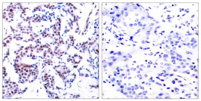 Phospho-JunB (Ser259) Antibody in Immunohistochemistry (Paraffin) (IHC (P))