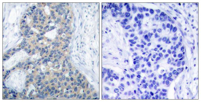 Phospho-Stathmin 1 (Ser38) Antibody in Immunohistochemistry (Paraffin) (IHC (P))