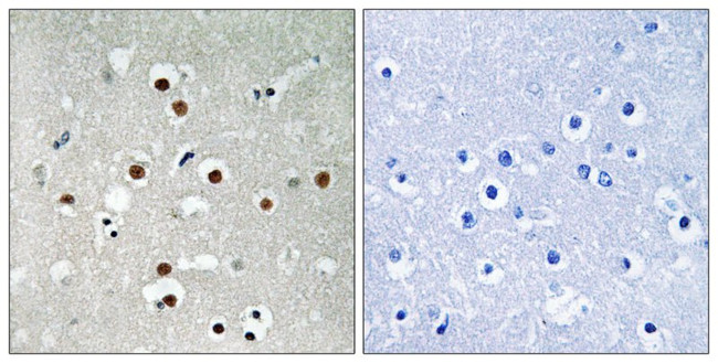 Phospho-MEF2C (Ser396) Antibody in Immunohistochemistry (Paraffin) (IHC (P))