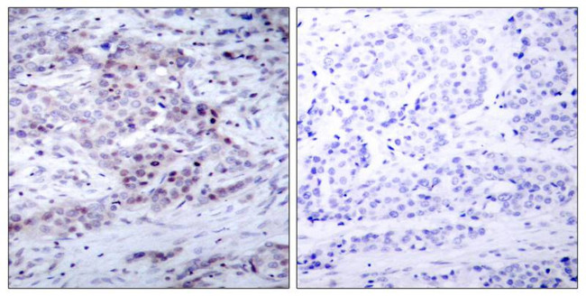 Phospho-NFkB p100 (Ser870) Antibody in Immunohistochemistry (Paraffin) (IHC (P))