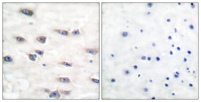 Phospho-TrkA (Tyr791) Antibody in Immunohistochemistry (Paraffin) (IHC (P))