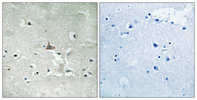 Phospho-TrkB (Tyr706, Tyr707) Antibody in Immunohistochemistry (Paraffin) (IHC (P))