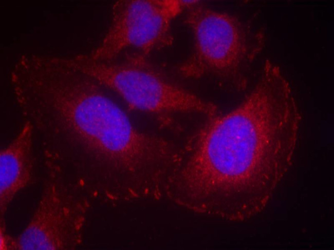 Phospho-PLCG1 (Tyr771) Antibody in Immunocytochemistry (ICC/IF)