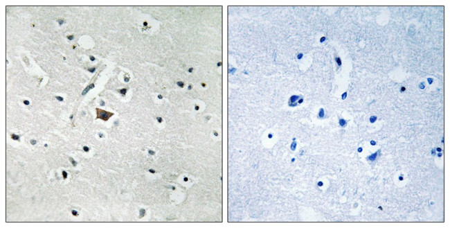 Phospho-PLD2 (Tyr169) Antibody in Immunohistochemistry (Paraffin) (IHC (P))