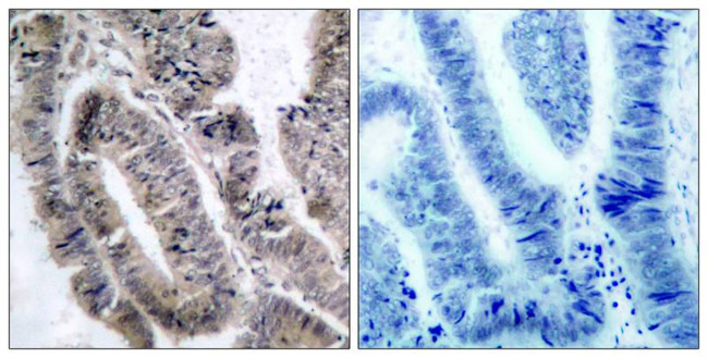 Phospho-AMPK alpha-1 (Ser496) Antibody in Immunohistochemistry (Paraffin) (IHC (P))