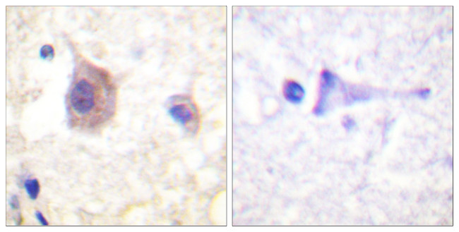 Phospho-PKC mu (Tyr463) Antibody in Immunohistochemistry (Paraffin) (IHC (P))