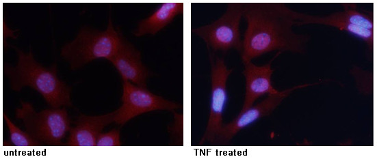 Phospho-NFkB p65 (Ser276) Antibody in Immunocytochemistry (ICC/IF)
