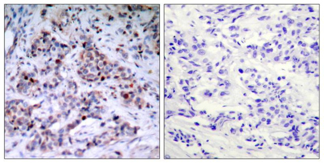 Phospho-NFkB p65 (Thr435) Antibody in Immunohistochemistry (Paraffin) (IHC (P))