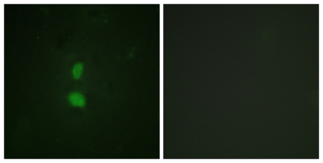 Phospho-SNAIL (Ser246) Antibody in Immunocytochemistry (ICC/IF)