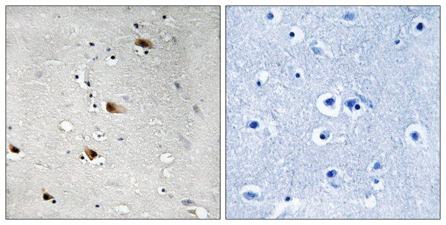 Phospho-TCF3 (Thr355) Antibody in Immunohistochemistry (Paraffin) (IHC (P))