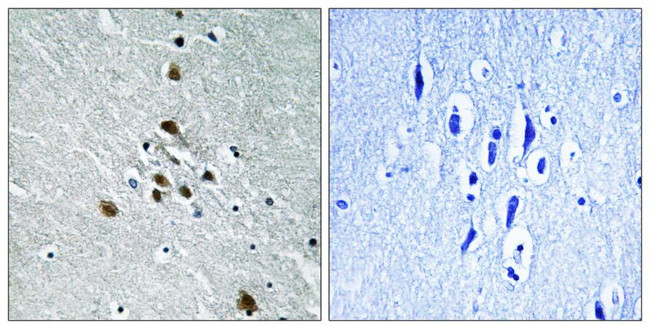 Phospho-SF1 (Ser82) Antibody in Immunohistochemistry (Paraffin) (IHC (P))