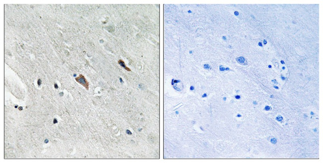 Phospho-GAB2 (Tyr643) Antibody in Immunohistochemistry (Paraffin) (IHC (P))