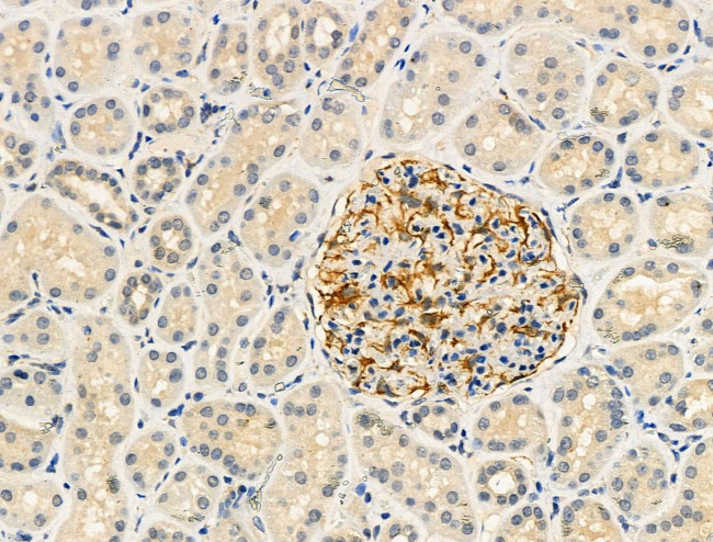 Phospho-RASGRF1 (Ser916) Antibody in Immunohistochemistry (Paraffin) (IHC (P))