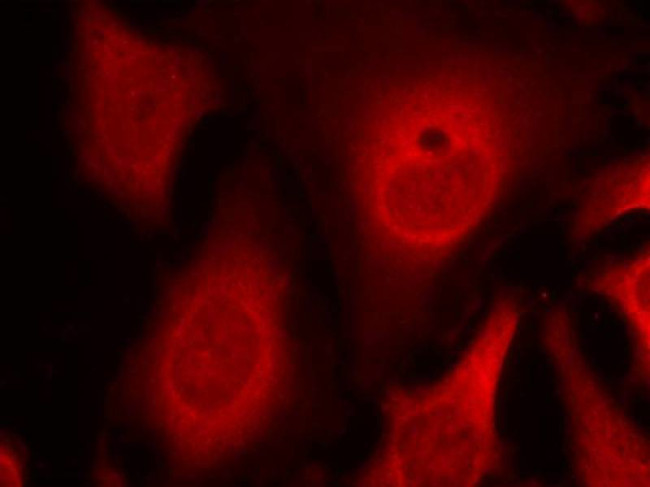 Phospho-EIF2S1 (Ser49) Antibody in Immunocytochemistry (ICC/IF)