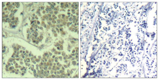 Phospho-EIF2S1 (Ser49) Antibody in Immunohistochemistry (Paraffin) (IHC (P))