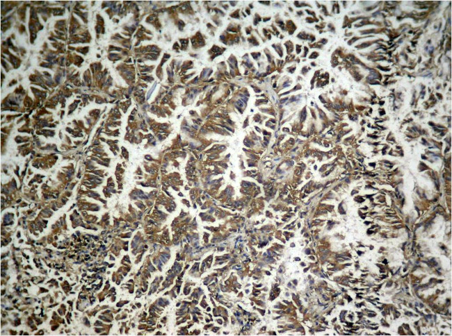 Phospho-EIF2S1 (Ser49) Antibody in Immunohistochemistry (Paraffin) (IHC (P))