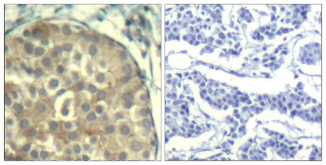 Phospho-Cofilin 1/2 (Tyr88) Antibody in Immunohistochemistry (Paraffin) (IHC (P))