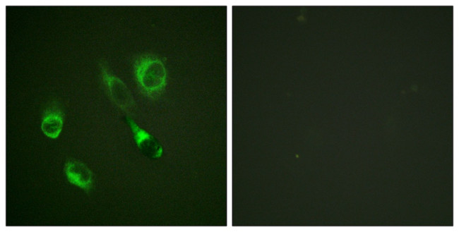 Phospho-EphA2/EphA3/EphA4 (Tyr588, Tyr596) Antibody in Immunocytochemistry (ICC/IF)