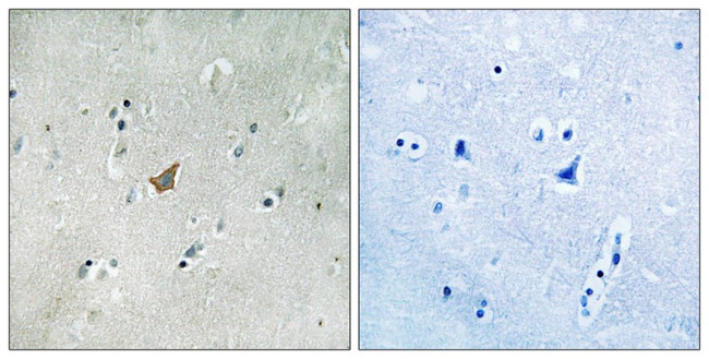 Phospho-EphA3/EphA4/EphA5 (Tyr779, Tyr833) Antibody in Immunohistochemistry (Paraffin) (IHC (P))