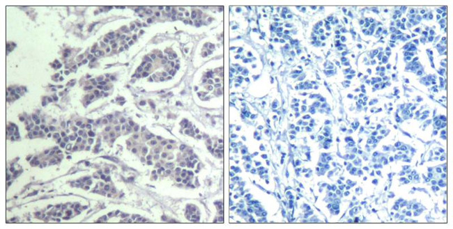 Phospho-AKT Pan (Tyr315, Tyr316, Tyr312) Antibody in Immunohistochemistry (Paraffin) (IHC (P))