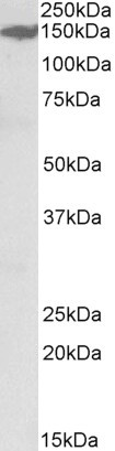 MAST3 Antibody in Western Blot (WB)