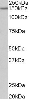 PCDH17 Antibody in Western Blot (WB)