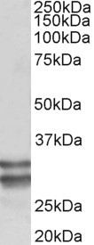 RFLAT-1 Antibody in Western Blot (WB)