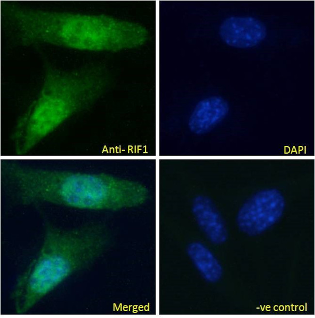 RIF1 Antibody in Immunocytochemistry (ICC/IF)