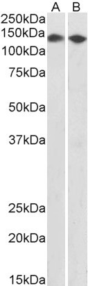 DBC1 Antibody in Western Blot (WB)