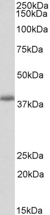 PDLIM2 Antibody in Western Blot (WB)