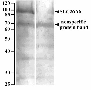 SLC26A6 Antibody in Western Blot (WB)