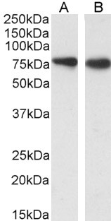 SLC26A6 Antibody in Western Blot (WB)