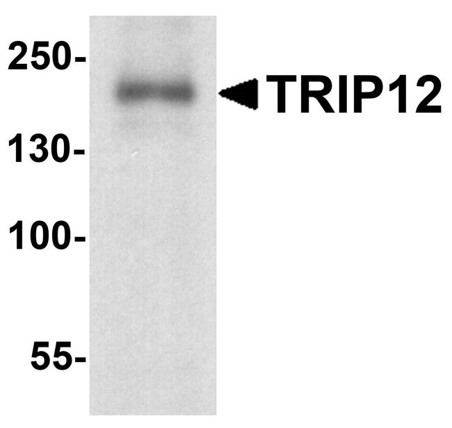 TRIP12 Antibody in Western Blot (WB)