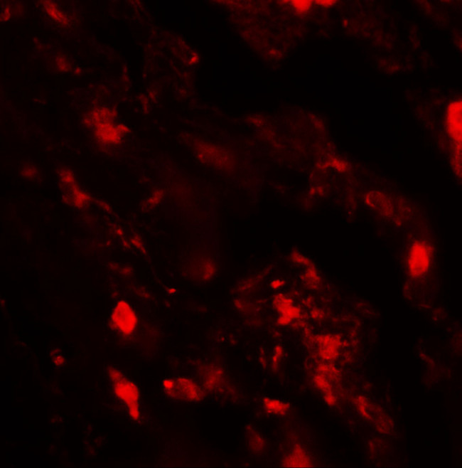 IL36B Antibody in Immunohistochemistry (Paraffin) (IHC (P))