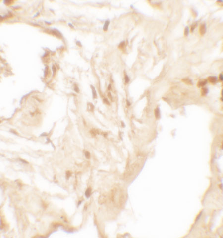 IL36B Antibody in Immunohistochemistry (Paraffin) (IHC (P))