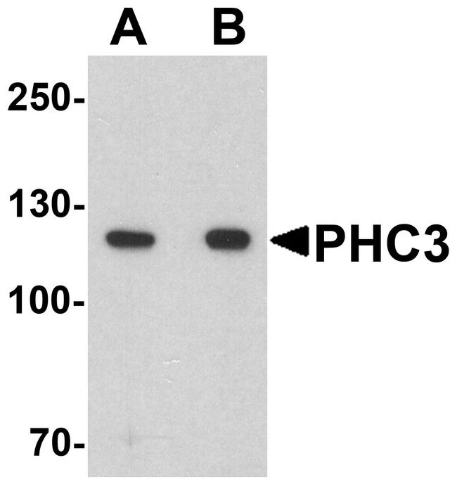 PHC3 Antibody in Western Blot (WB)