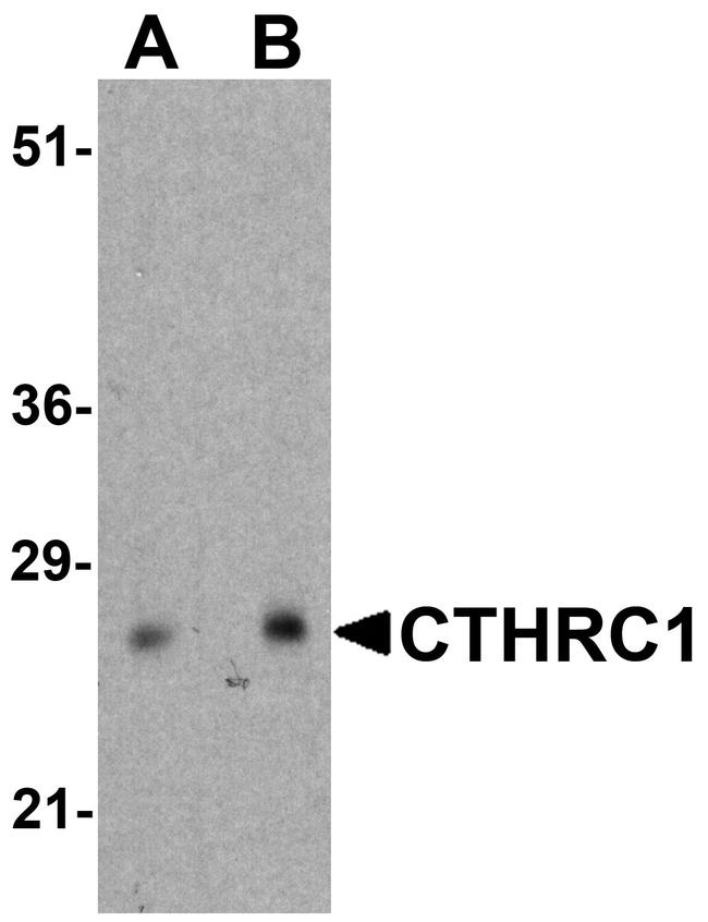 CTHRC1 Antibody in Western Blot (WB)