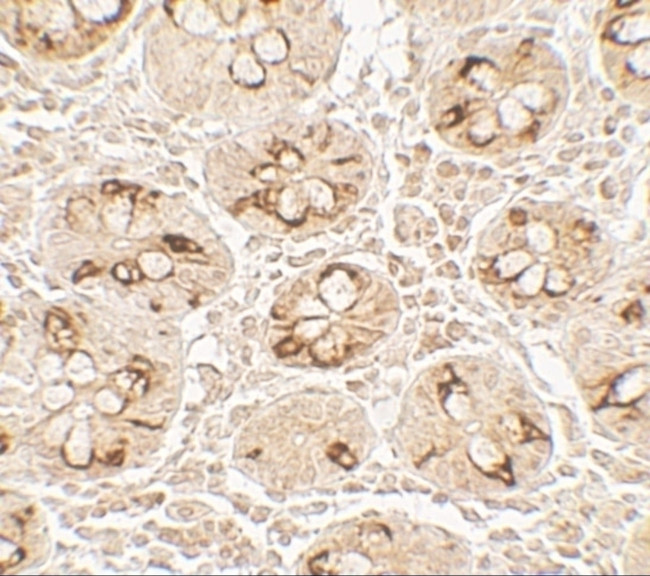 TMIGD2 Antibody in Immunohistochemistry (Paraffin) (IHC (P))